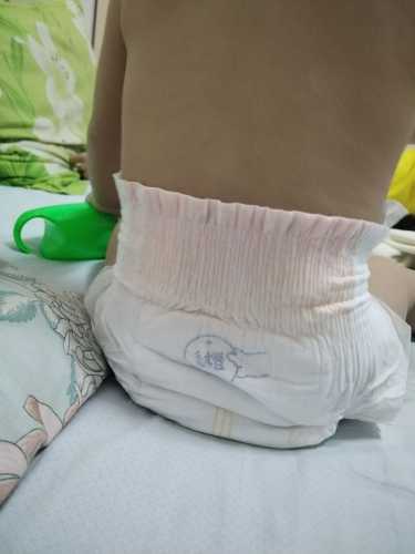 穿了尿不湿正常吗-第1张图片