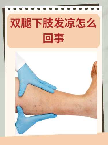 产后血液循环不好有啥症状-第1张图片