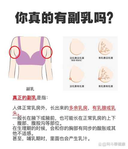 产后有副乳该怎么解决-第1张图片