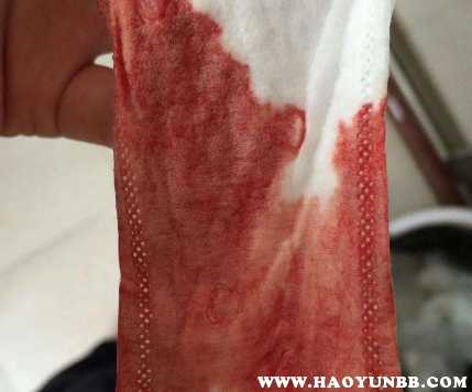 产后一月还有恶露正常吗-第1张图片