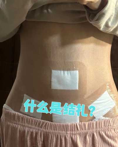 剖腹产两次结扎后能复通再生吗-第1张图片