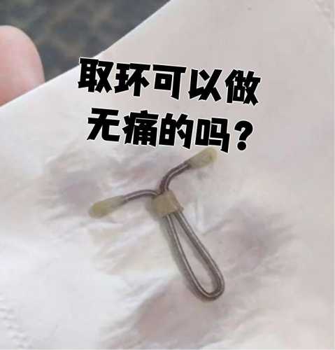 停经后能否取环备孕-第1张图片