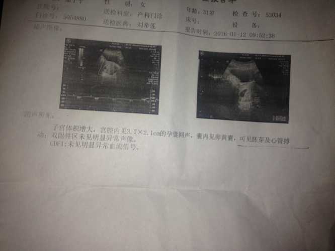 产后五十天又见红咋回事-第1张图片