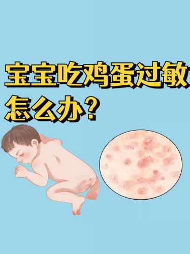 辅食过敏怎么办-第1张图片