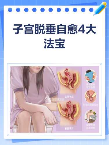 产后宫颈口脱垂如何应对-第1张图片