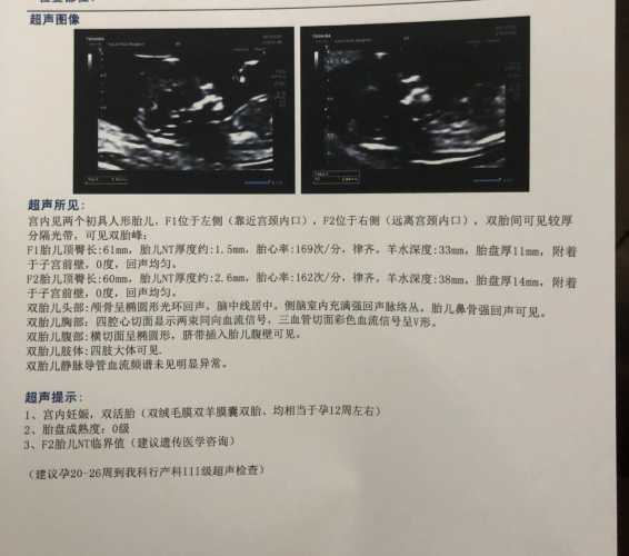 孕12周血糖53有孕反正常吗-第1张图片