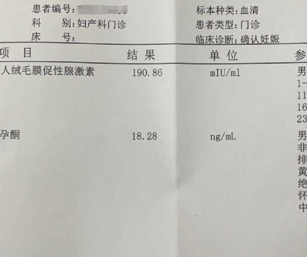 尿检能查出怀孕多久时间吗-第1张图片