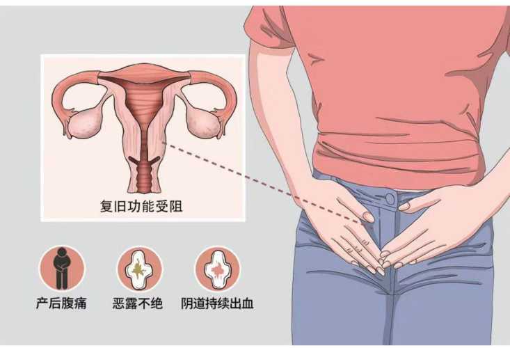 产后子宫图是怎样的-第1张图片