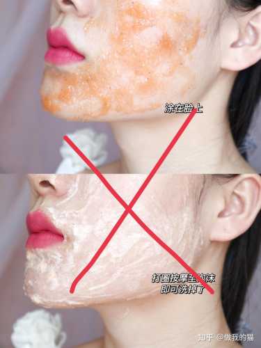 怀孕能激光去脂肪粒吗-第1张图片