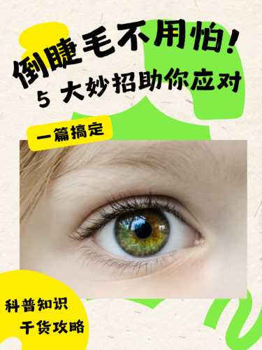 婴儿睫毛倒长怎么办-第1张图片