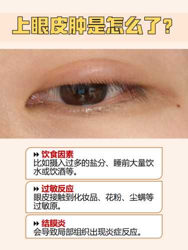 婴儿眼睑红肿是怎么回事-第1张图片