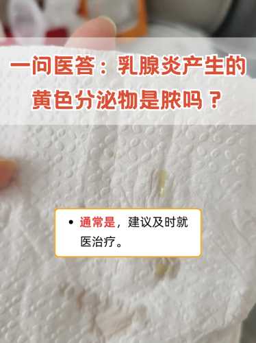 产后乳头有脓怎么办-第1张图片