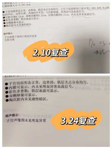 瘢痕憩室很大影响备孕吗-第1张图片