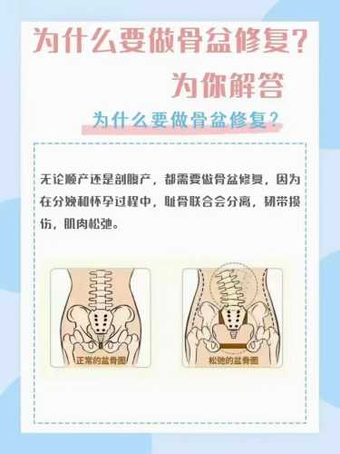 产后骨盆移位该如何应对-第1张图片