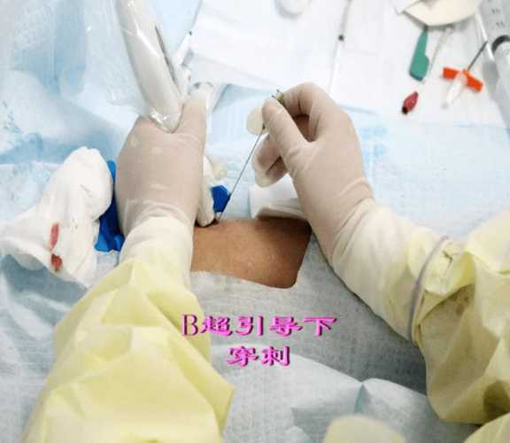 产后镇痛针真的安全有效吗-第1张图片