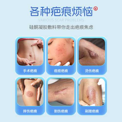 剖腹产修复疤痕膏真的有用吗-第1张图片