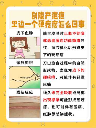 剖腹产伤口破裂怎么办-第1张图片