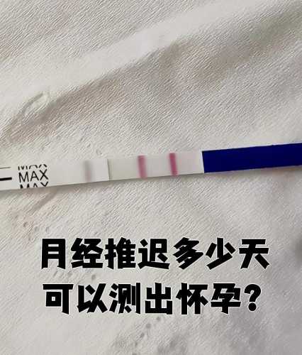 验白带能验出怀孕吗-第1张图片