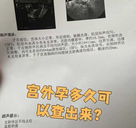 怀孕大概多少天能查出来-第1张图片