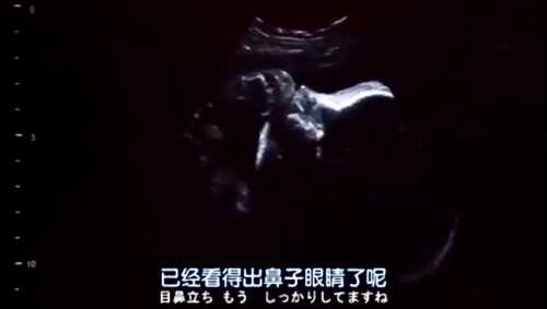 孕妇梦见自己要剖腹产啥意思-第1张图片